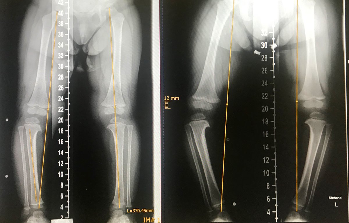 Patientengeschichte von Maya