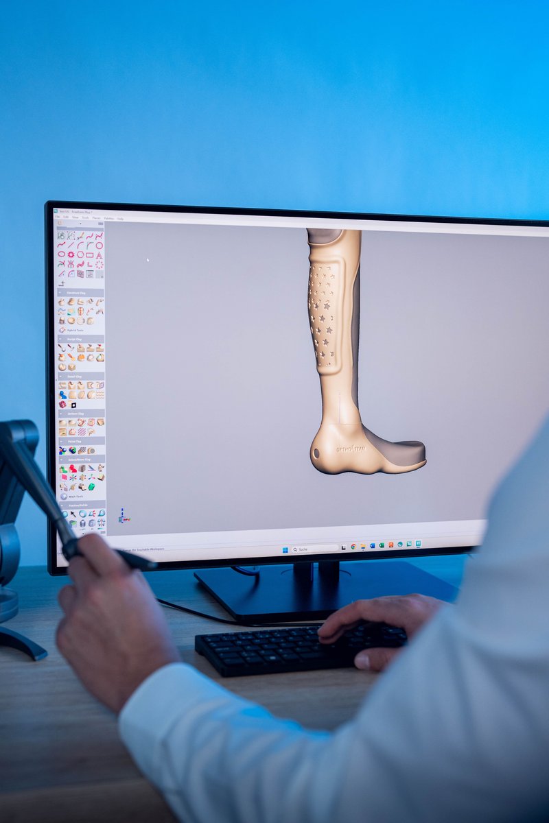 Digitalisierung und X-Perience in der Orthopädietechnik