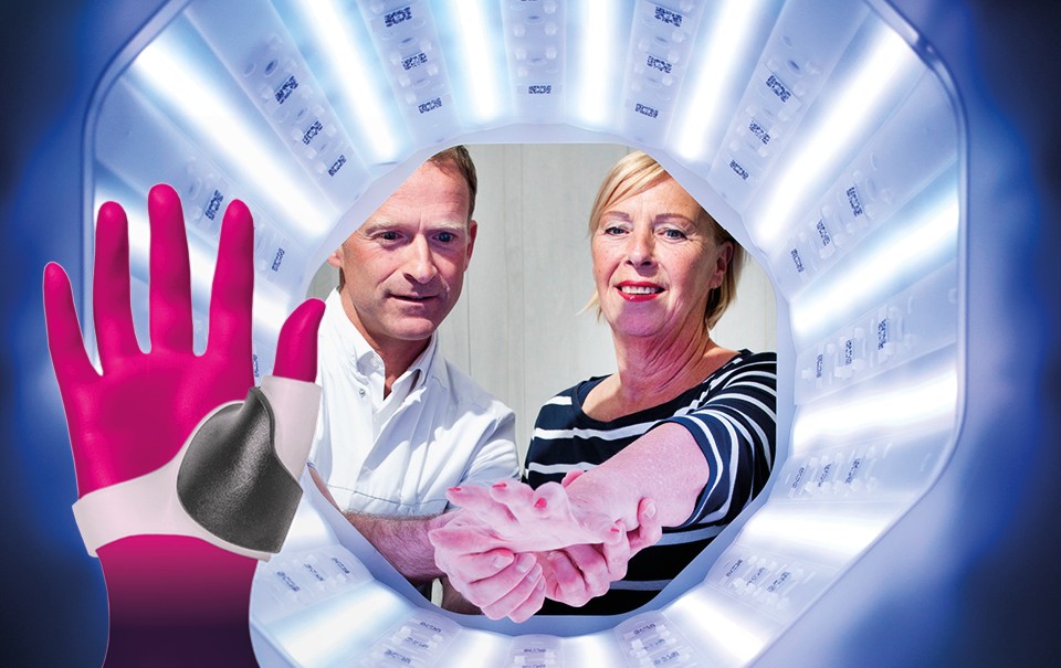 Daumenschienen 3D-Silikondruck